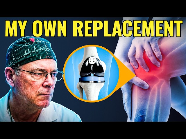 I’m a Knee Surgeon — 5 Things I Learned From My Own Knee Replacement