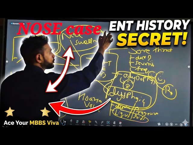 History Taking in NOSE case. How to Score Full Marks in ENT Viva