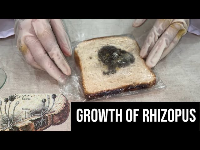 Bread mould under the Microscope| Rhizopus Growth Explained |
