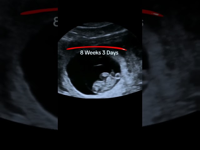 Ultrasound showing 8 weeks 3 days baby #baby #ultrasound #pregnant #shorts