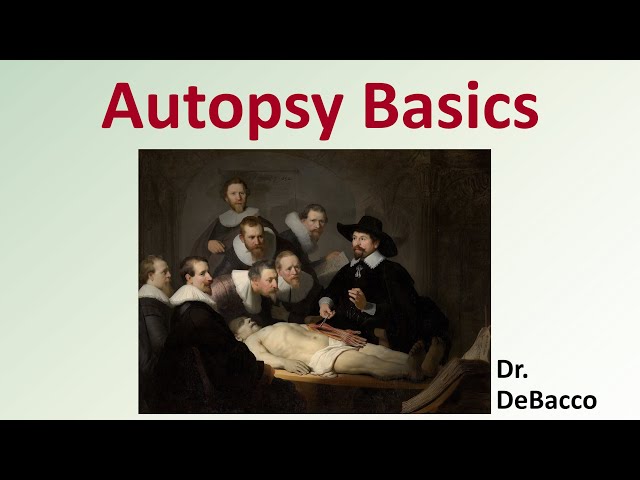 Autopsy Basics