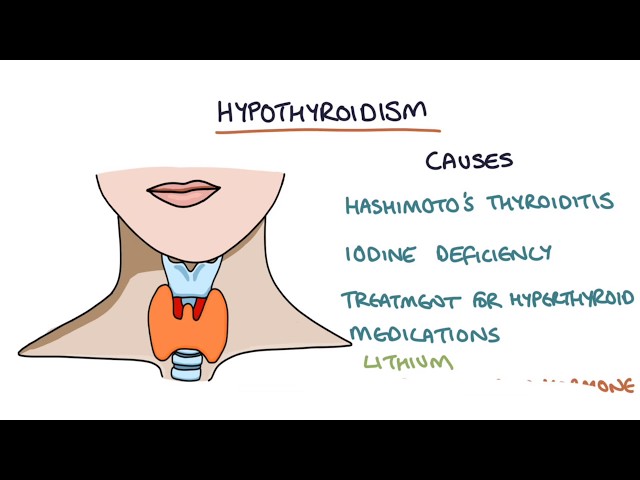 Hypothyroidism and Hashimoto's Thyroiditis: Visual Explanation for Students