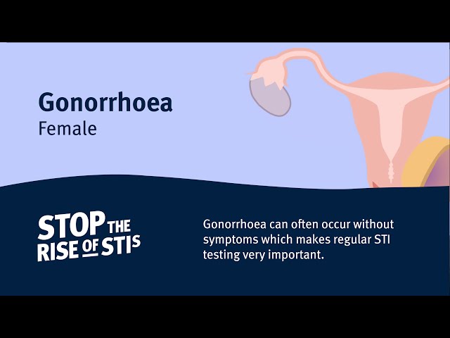 Sexual Health - Gonorrhoea (Female)