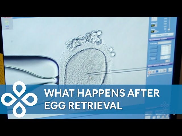IVF Procedure Step by Step - Part 3
