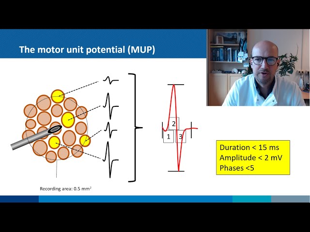 Needle EMG: primer