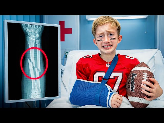 Levi Broke His Arm..
