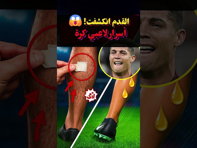 ليش لاعبين الكرة يحلقون رجولهم؟! ⚽️😱