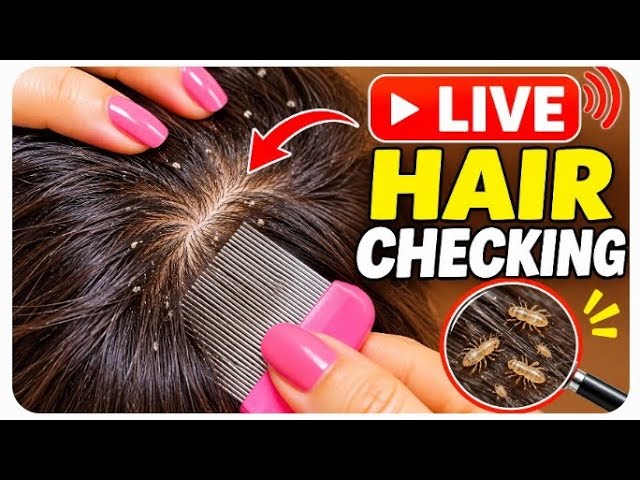 🔴 LIVE Head Lice Checking | Hair & Scalp Inspection 🔍