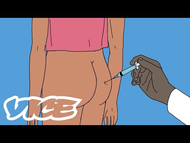 STD Glossary: Gonorrhea