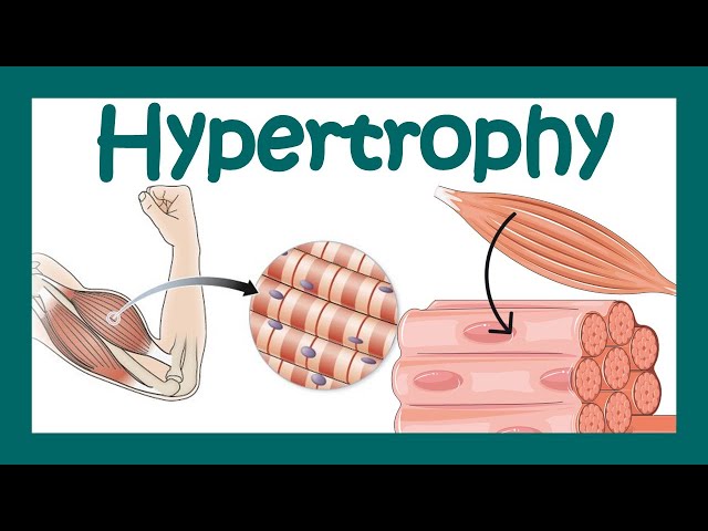 Hypertrophy | What is hypertrophy? | Mechanism of muscle hypertrophy | How does hypertrophy happen?