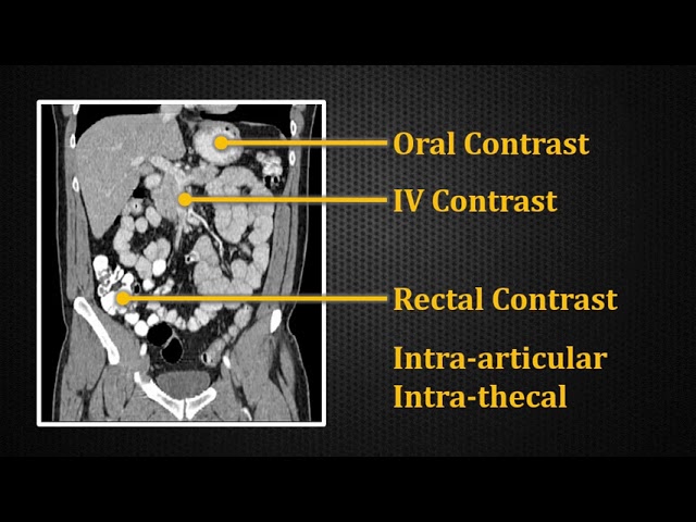 Introduction to Contrast Enhacement: Computed tomography (CT) explained