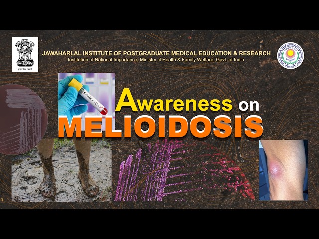 JIPMER Med Talk | Awareness on Melioidosis | Expert Guidance for Better Health