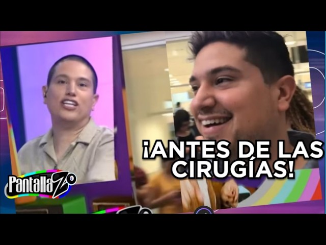 Revelan fotos de Aldo Muñiz antes de sus cirugías | Pantallazo