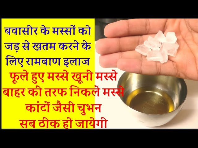 bawaseer ka ilaj,elaj,bawaseer ki dawai,bawaseer ke masse, बवासीर के मस्सों का इलाज (home remedy)