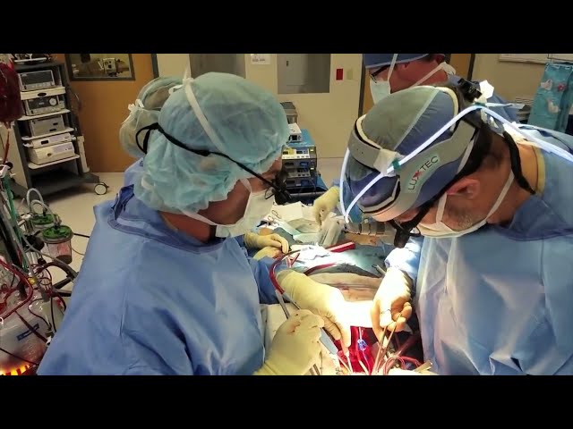 Life in the OR: Open heart surgery