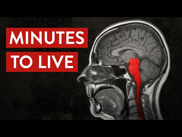 Why Agonal Breathing is Terrifying