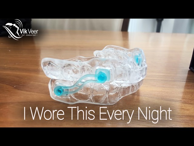 My Honest Review After 4 Months Using a Mandibular Advancement Device (MAD)