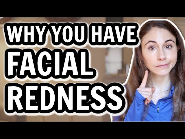 10 REASONS YOUR FACE IS RED ALL THE TIME & HOW TO GET RID OF REDNESS // DERMATOLOGIST @DrDrayzday