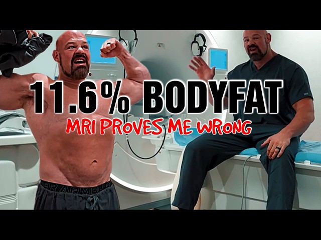 Brain Shaw 11.6% || MRI Proves Me Wrong