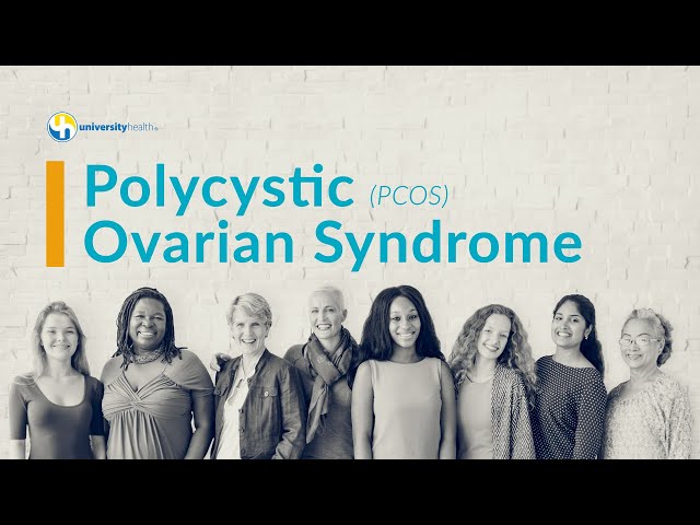 Polycystic Ovarian Syndrome (PCOS) Symptoms and Treatment