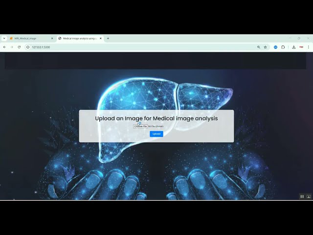 Liver Segmentation using Unet Medical Image Analysis in Python Projects