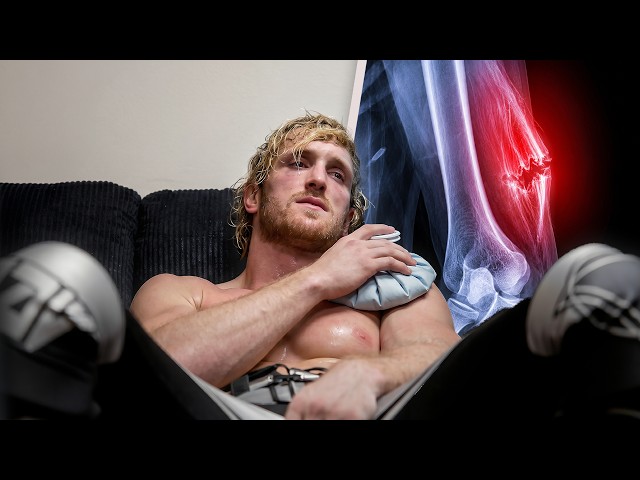 I Tore My Tricep (6 Month Recovery)