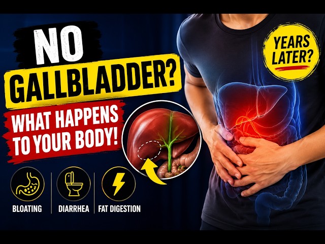 What Nobody Tells You After Gallbladder Removal | Digestive Health Explained
