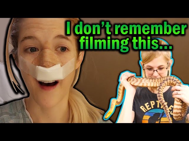 My Rhinoplasty- Do Reptiles Smell Different after Nose Surgery?