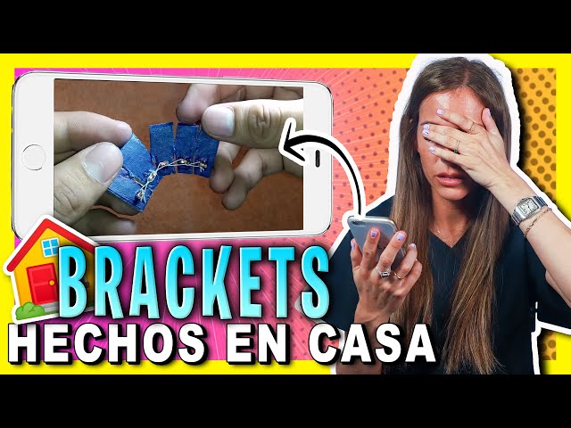 𝗗𝗲𝗻𝘁𝗶𝘀𝘁𝗮 𝗥𝗲𝗮𝗰𝗰𝗶𝗼𝗻𝗮 a "Como hacer 𝗕𝗥𝗔𝗖𝗞𝗘𝗧𝗦 𝗖𝗔𝗦𝗘𝗥𝗢𝗦 Paso a Paso"  Endereza los dientes chuecos en CASA