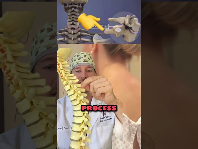 What is the bump on the back of your neck?! (Spine expert explains) 🤯
