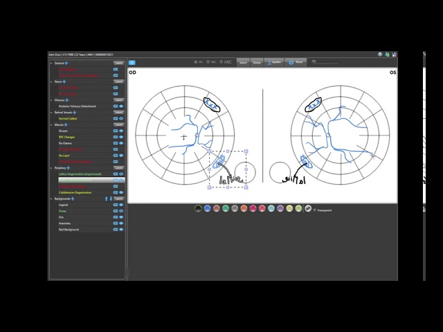 Nextech IntelleChart Pro - IntelleDraw