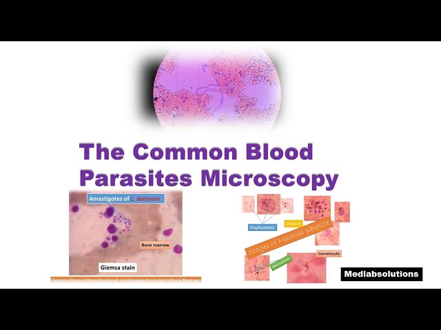 The most common blood parasites Microscopy/Malarial Parasites/Leishmania/Microfilaria