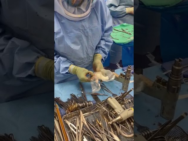 Direct Anterior Total Hip Replacement